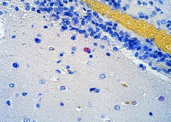 ¿Qué debemos saber sobre el virus Nipah?