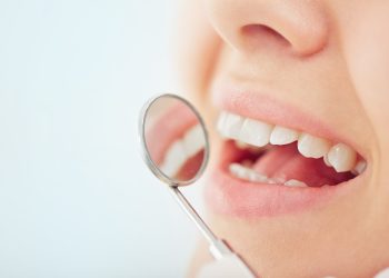 Conoce qué alimentos pueden ayudar a prevenir  las caries y mantener una buena salud bucodental