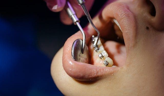 ¿Cómo saber si necesitas frenillos? Claves y señales a las que estar atentos
