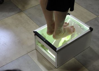 Más de 1.800 pacientes talquinos accederán a terapia innovadora para tratar el pie diabético