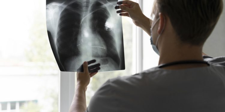 Hospital Regional de Talca llama a la prevención ante alta circulación viral respiratoria