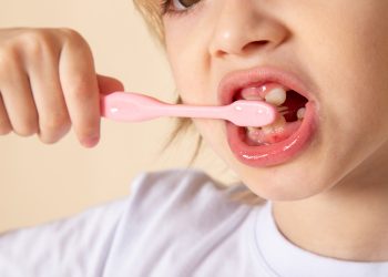 ¿Por qué aumentan las caries en niños en verano?