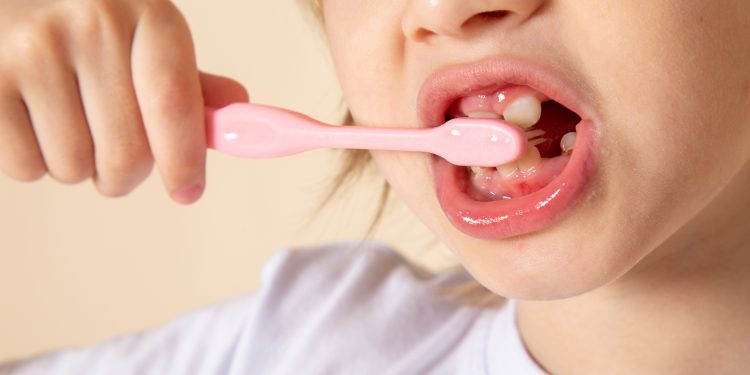 ¿Por qué aumentan las caries en niños en verano?