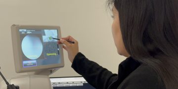 Glaucoma: El enemigo silencioso que puede dejar ciego a quienes lo padecen