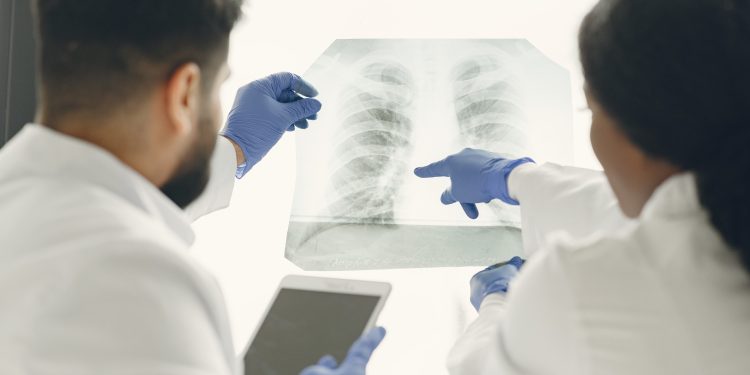 Tuberculosis: Cómo se transmite y cuáles son sus síntomas
