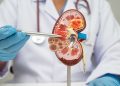 Cáncer de riñón: cuándo preocuparse y cuándo consultar a un médico