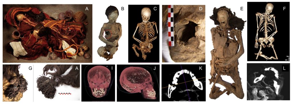 Estudio internacional revela que “Niño del Cerro El Plomo” murió en un ritual de sacrificio Inca y no de hipotermia