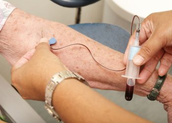 Investigadores logran estimar riesgo de fragilidad a partir de exámenes de sangre