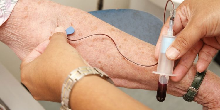 Investigadores logran estimar riesgo de fragilidad a partir de exámenes de sangre