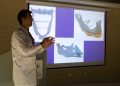 Hospital de Curicó destaca a nivel nacional con pionera tecnología de impresión 3D para cirugías maxilofaciales